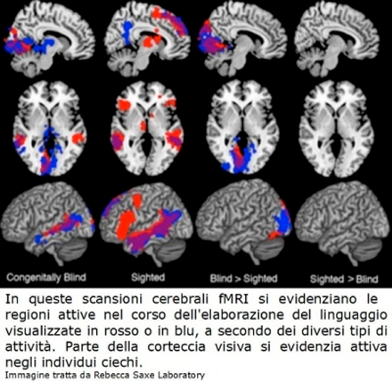 Risonanza magnetica funzionale